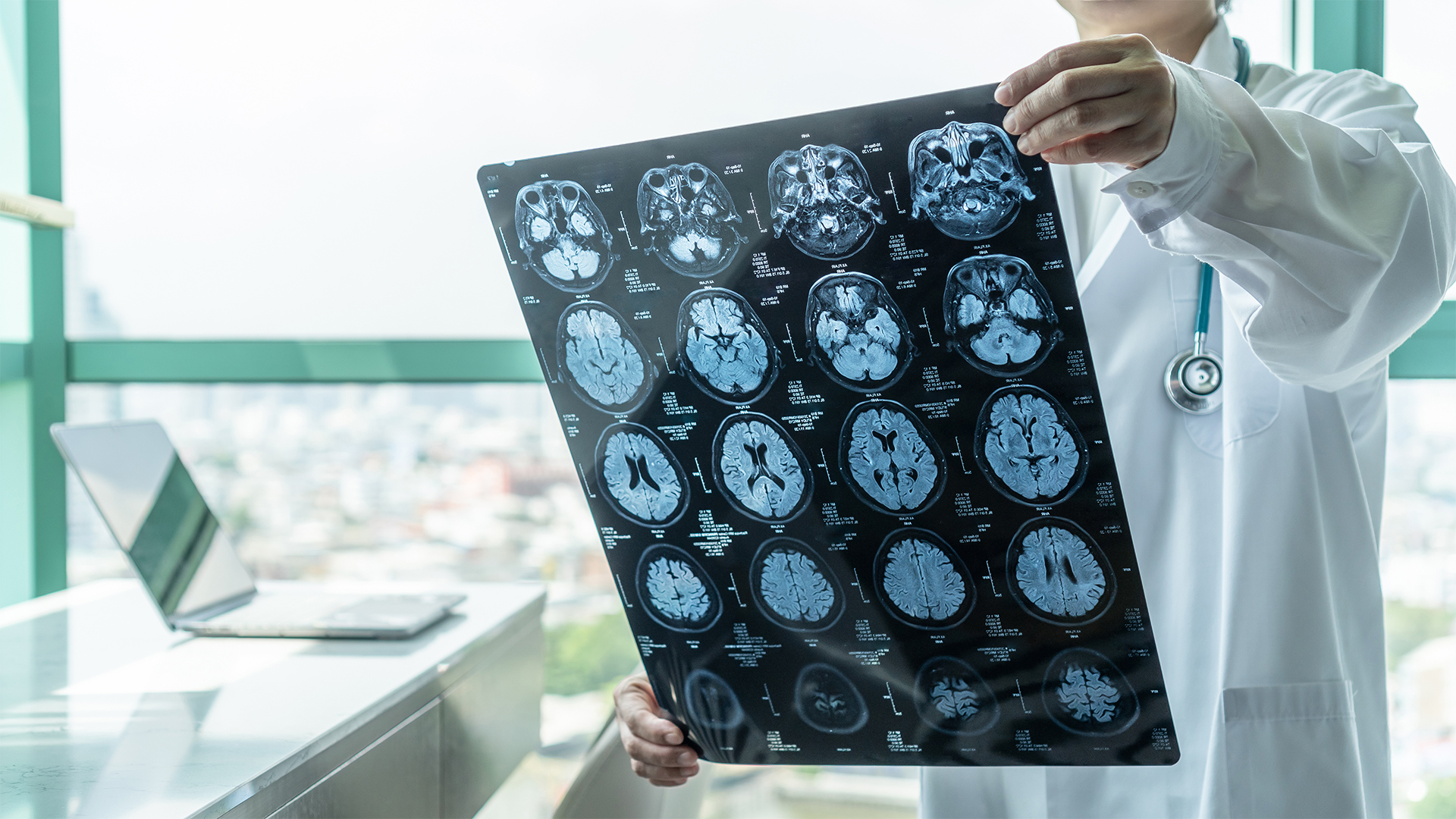A nemi erőszak és szexuális trauma agyi károsodást okozhat